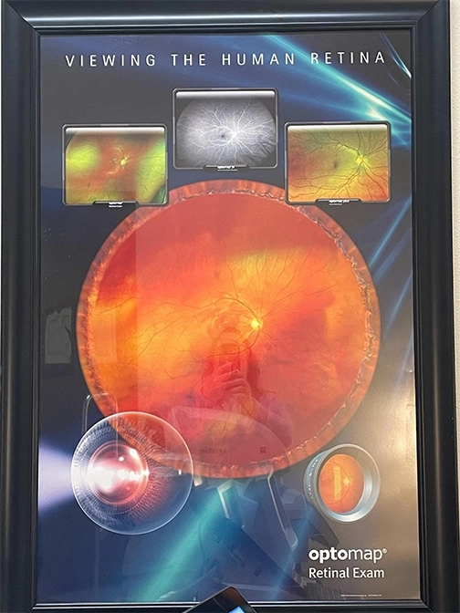 An Optomap demonstrates the 180 degree imaging capabilities of the Optos Machine.